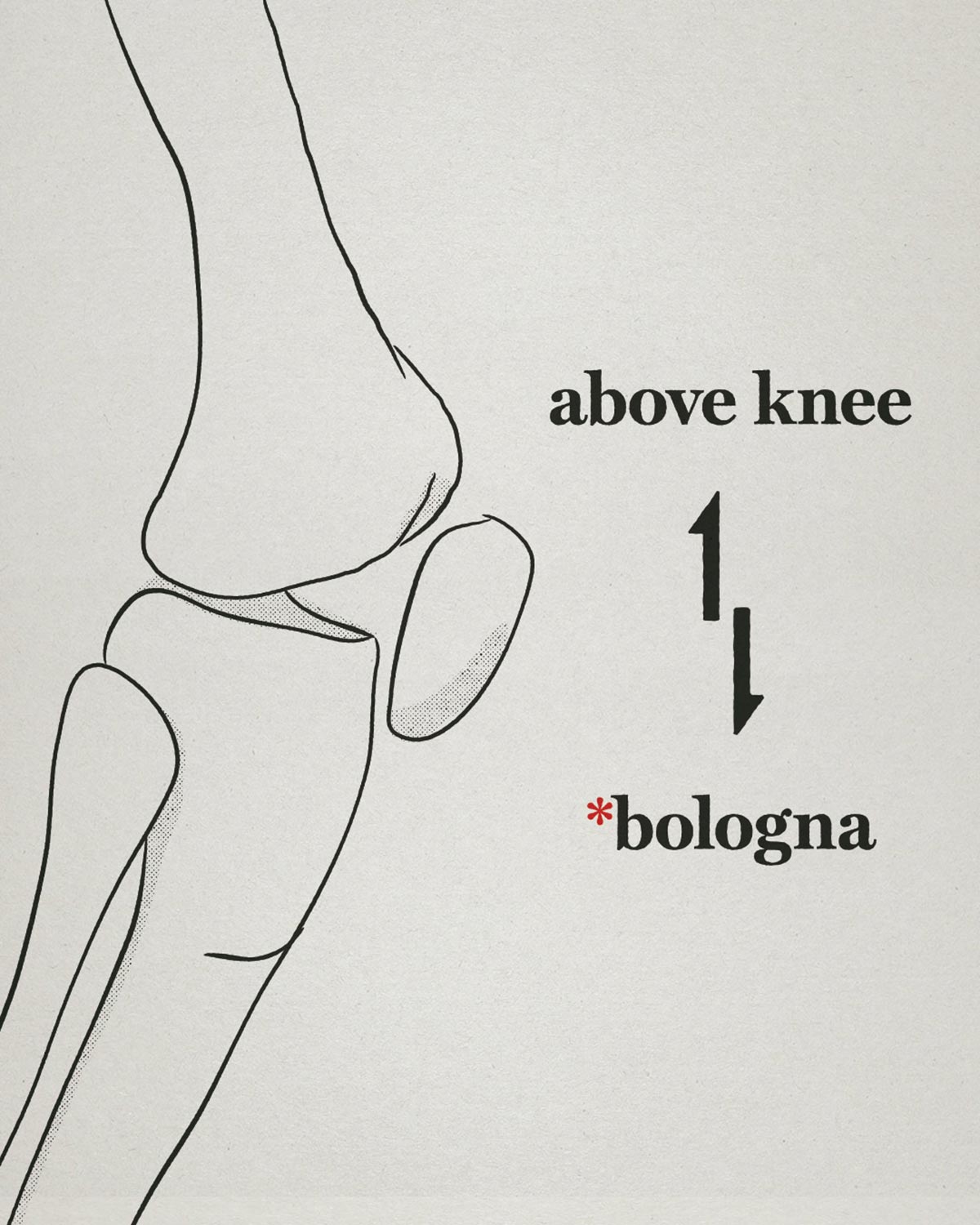 belowknee